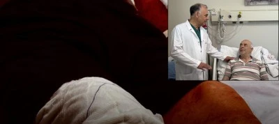 70 yaşındaki adam dehşeti yaşadı, v&uuml;cudunun y&uuml;zde 20&rsquo;si yandı