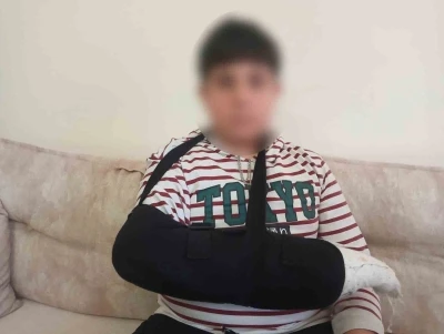Ortaokul &ouml;ğrencisi, kendisinden 3 yaş k&uuml;&ccedil;&uuml;k &ouml;ğrencinin parmağını kırdı