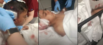 Ankara&rsquo;da sokak k&ouml;peğinin saldırısına uğrayan &ccedil;ocuk yaralandı