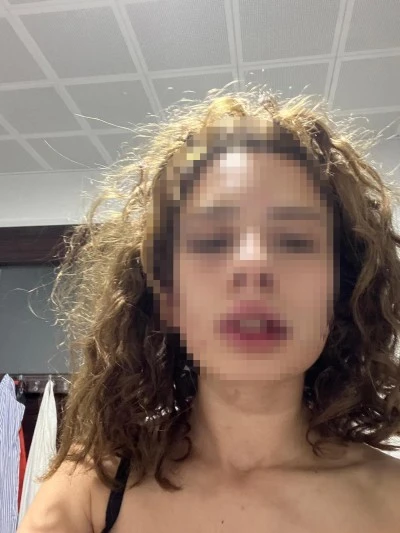 Ayrılmak isteyen sevgilisini bayıltana kadar d&ouml;vd&uuml;