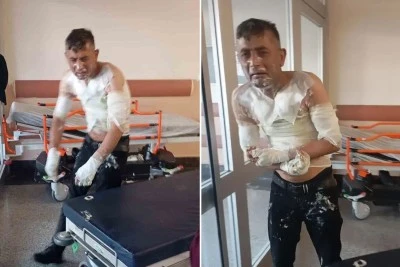 Bu şekilde vicdansızlık g&ouml;r&uuml;lmedi: Engelli vatandaşı benzin d&ouml;k&uuml;p yaktı