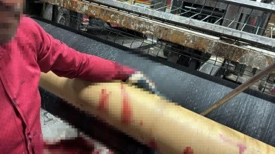 Bursa'da bir iş&ccedil;i ağır yaralandı 