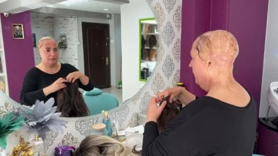 Bursa'da yaşadığı feci iş kazasının ardından kadınlara umut oluyor!
