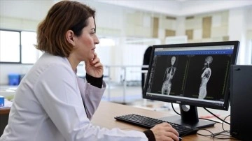 &Ccedil;ocuklarda skolyozun erken tanısında ebeveynlere de g&ouml;rev d&uuml;ş&uuml;yor