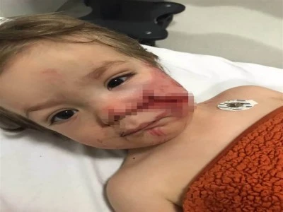 &Ccedil;ocuklarına pitbull saldıran acılı baba isyan etti