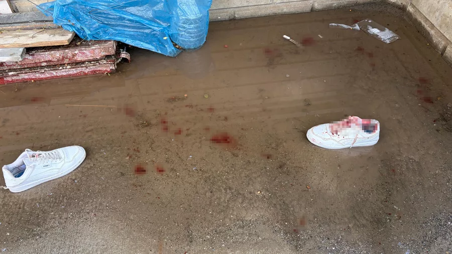 Dehşet sa&ccedil;an saldırgan kendisine de zarar verdi