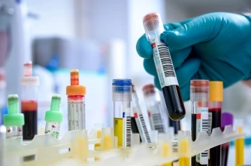 Demans ve ALS hastalarına umut olacak &ccedil;alışma
