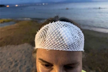 Denizde y&uuml;zerken jet ski &ccedil;arptı, &ouml;l&uuml;mden d&ouml;nd&uuml;
