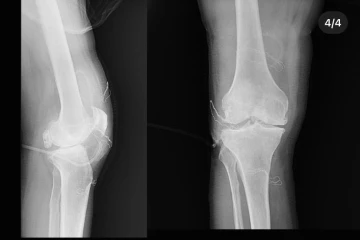Dizden &ccedil;ıkan eklem fareleri şaşırttı
