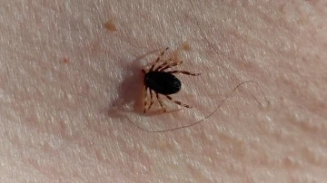 Doğu Karadeniz&rsquo;de kenede bu yaz korkulan olmadı
