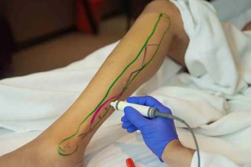 Doku transferiyle yara onarımında yeni d&ouml;nem
