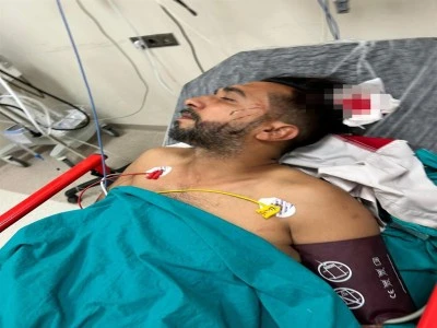 D&ouml;ner yerken başına kurşun isabet etti