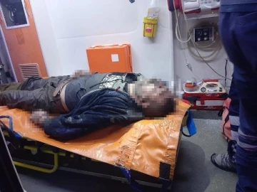 Elinde sigarayla uyudu, koltuk tutuşunca &ccedil;ıkan yangında ağır yaralandı