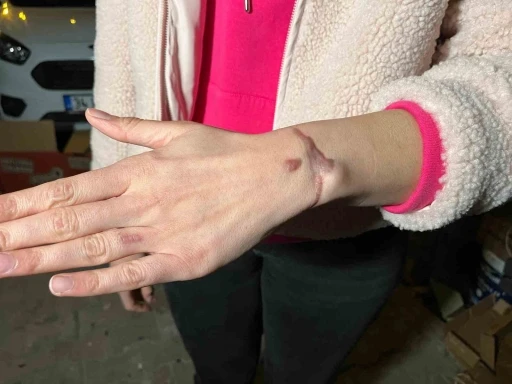 D&ouml;vme sildirme işlemi yaptıran kadın kabus yaşadı