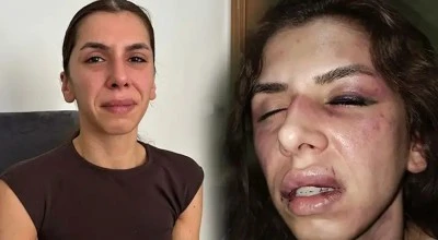 Eşi tarafından işkence g&ouml;ren gen&ccedil; kadının haykırışı: &Ouml;lmek istemiyorum...