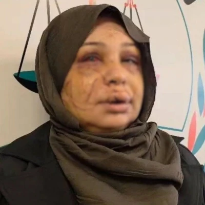 Eşini yaralayan polis memurunun dosyası, ağır cezaya g&ouml;nderildi