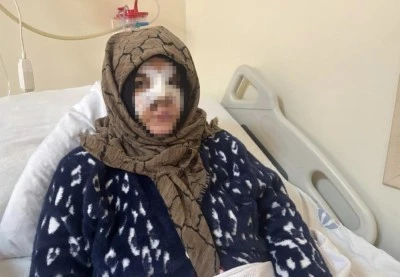 Eşinin y&uuml;z&uuml;n&uuml; taşla ezdi