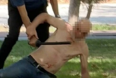 Esnafa bı&ccedil;akla saldırınca d&ouml;v&uuml;ld&uuml;, hastaneden ka&ccedil;ıp, intihara kalkıştı