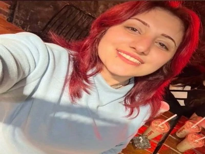 Estetik ameliyatına gitti hayatından oldu
