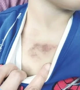 Ey&uuml;psultan'da 3 yaşındaki &ccedil;ocuğa şiddet iddiası