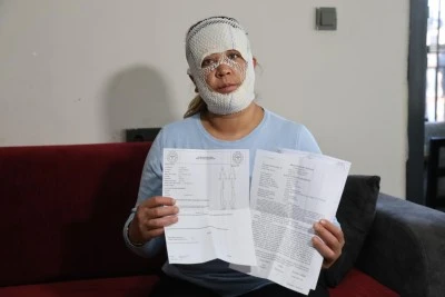 Gen&ccedil; kadın 'Prenses cilt bakımı' yaptırdı kabusu yaşıyor! 