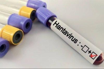 Hantavir&uuml;s Bir Salgına D&ouml;n&uuml;ş&uuml;r m&uuml;?