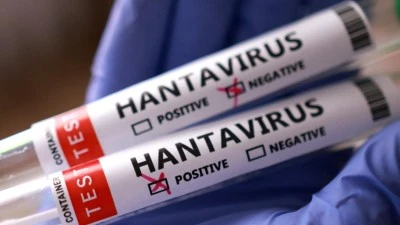 Hantavir&uuml;s hakkında merak edilenler a&ccedil;ıklandı