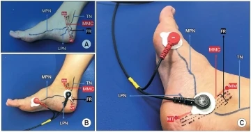 İdrar ka&ccedil;ırmada PA&Uuml; Tıp Fak&uuml;ltesi&rsquo;nden d&uuml;nyada ilk
