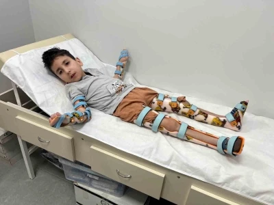 İHA&rsquo;nın haberinden sonra yardımlar devam eden &ccedil;ocuğa KAFO cihazı alındı