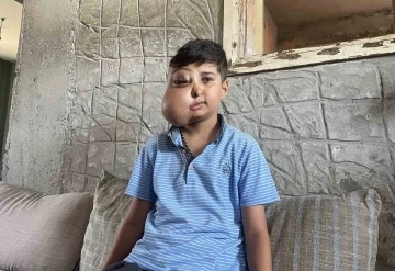 İki farklı y&uuml;z&uuml; var gibi g&ouml;r&uuml;nen &ccedil;ocuğun tek isteği iyileşip g&uuml;lmek
