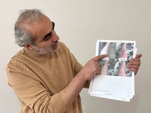 Jeoloji m&uuml;hendisi sedef, egzama, uyuz ve vitiligo i&ccedil;in krem &uuml;retti
