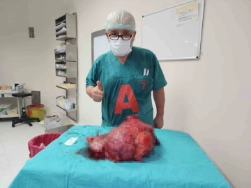 Karın ağrısı şikayetiyle gitti, 10 kiloluk dev t&uuml;m&ouml;r &ccedil;ıkartıldı
