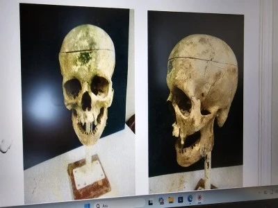 &lsquo;Kirpi Ahmet&rsquo; cinayetinin gizemi 18 yıl sonra &ccedil;&ouml;z&uuml;ld&uuml;