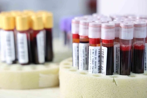 Kızılay&rsquo;a 2024&rsquo;te 2 milyon 800 bin &uuml;nite kan bağışlandı
