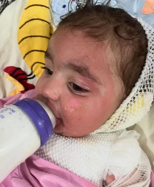 Kreşte &ccedil;ocuğun &uuml;zerine kahve d&ouml;k&uuml;ld&uuml;
