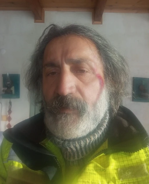 Kurt saldırısından k&ouml;pekleri sayesinde kurtuldu
