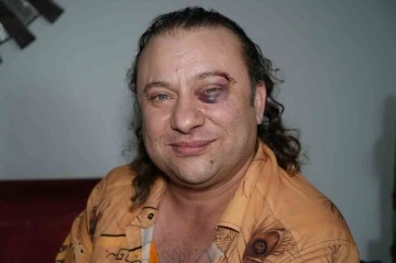 Magazin yazarı ve TSM sanat&ccedil;ısı Onur Akay saldırıya uğradı
