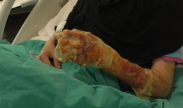 Mangal ateşine dezenfektan d&ouml;ken &ccedil;ift dehşeti yaşadı: "Eşim ateşi harlamak istedi, l&uuml;tfen acele etmeyin"
