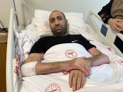 Mangal yapmak isterken v&uuml;cudunun y&uuml;zde 80&rsquo;i yaktı