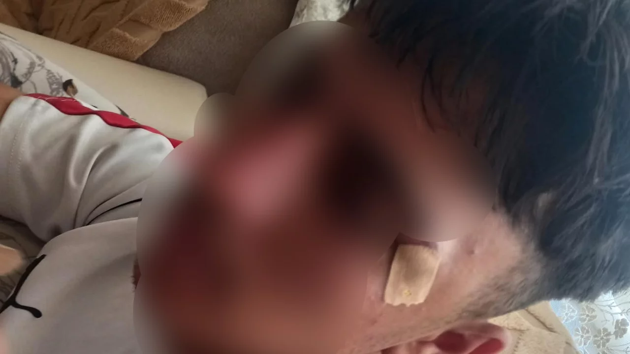 Mesleki eğitim merkezinde &ouml;ğretmenin kafa attığı &ouml;ğrenci hastanelik oldu