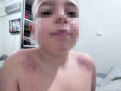 Oğlunu darbettiğini iddia ettiği &ouml;ğretmenden şikayet&ccedil;i oldu