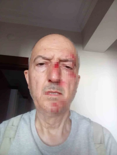 &Ouml;nce icra yoluyla evinden tahliye edildi, ardından darp edildi