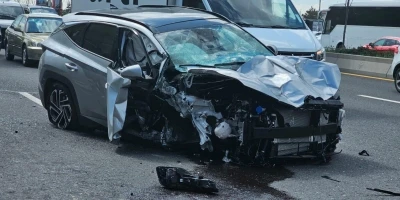 Otomobil, &uuml;st ge&ccedil;it ayağına &ccedil;arptı: 2 yaralı