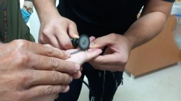 Parmağına sıkışan y&uuml;z&uuml;ğ&uuml; itfaiye g&ouml;revlisi keserek &ccedil;ıkardı