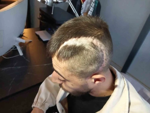 Patronunun &ouml;ld&uuml;resiyle darp ettiği &ccedil;alışan y&uuml;zde 32 fiziksel engelli kaldı
