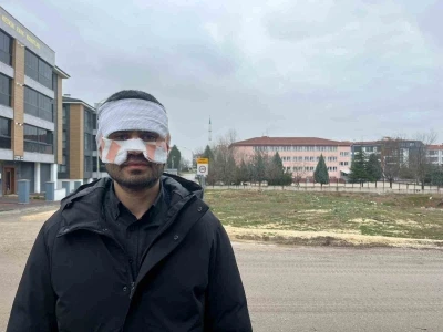 Pes!  Rehber &ouml;ğretmenin  sıcak &ccedil;ay fırlattığı fizik &ouml;ğretmeninin y&uuml;z&uuml; haşlandı