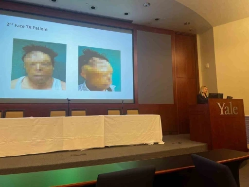 Rekt&ouml;r &Ouml;zkan, Yale&rsquo;de T&uuml;rkiye&rsquo;nin sağlık alanındaki başarısını anlattı
