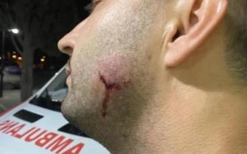 Sağlık &ccedil;alışanlarına saldıran uzman &ccedil;avuş a&ccedil;ığa alındı