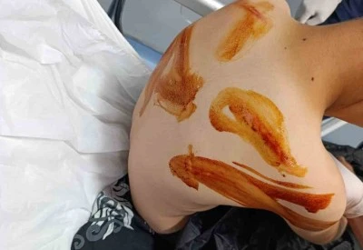 Şanlıurfa&rsquo;da 11 yaşındaki &ccedil;ocuğa &ouml;ld&uuml;resiye dayak