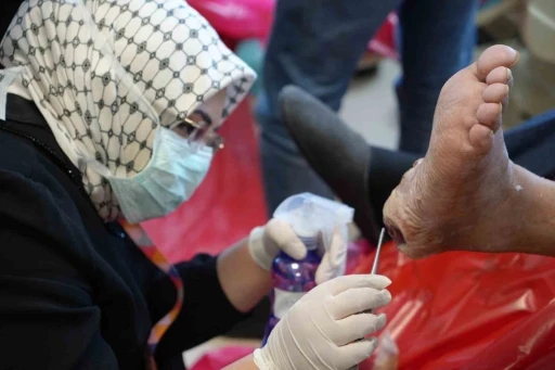 Sinek larvaları ile yara tedavisi: &Ccedil;&uuml;r&uuml;m&uuml;ş dokuları yiyorlar, b&ouml;lge kesilmekten kurtuluyor
